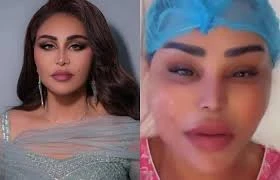 أحلام تثير الجدل وتخطف الأنظار بكشفها تفاصيل تقنية تجميلية حديثة لشد الوجه